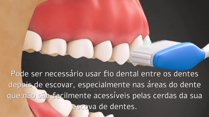 Tecnica de Escovagem